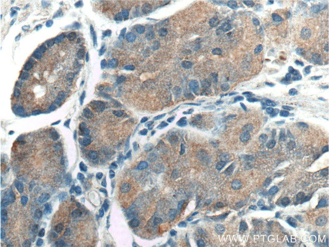 TAC1 Antibody in Immunohistochemistry (Paraffin) (IHC (P))