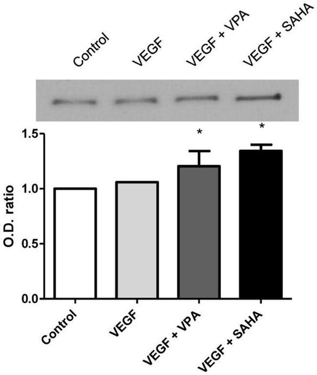 beta Catenin Antibody in Western Blot (WB)