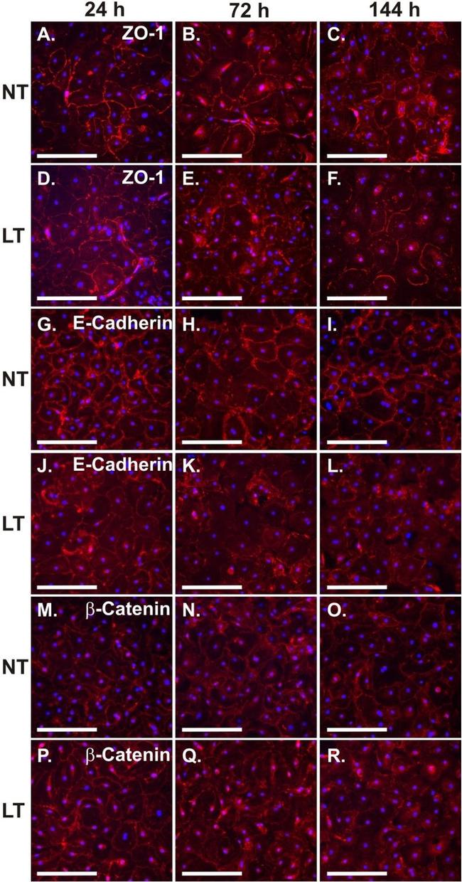 beta Catenin Antibody in Immunocytochemistry (ICC/IF)