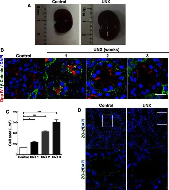 beta Catenin Antibody in Immunohistochemistry (IHC)