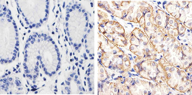 beta Catenin Antibody in Immunohistochemistry (Paraffin) (IHC (P))