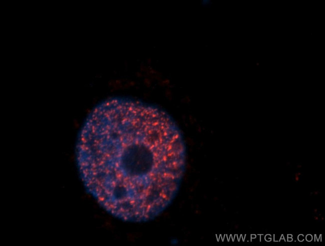 SAP18 Antibody in Immunocytochemistry (ICC/IF)