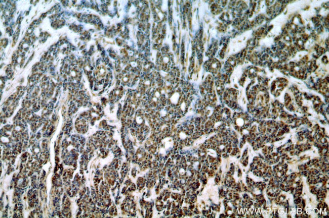 SAP18 Antibody in Immunohistochemistry (Paraffin) (IHC (P))