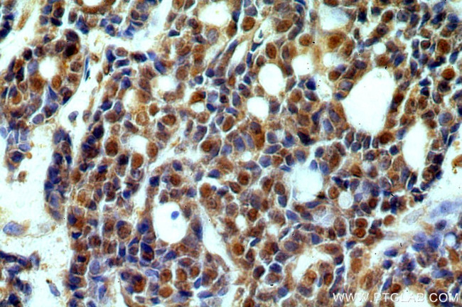 SAP18 Antibody in Immunohistochemistry (Paraffin) (IHC (P))