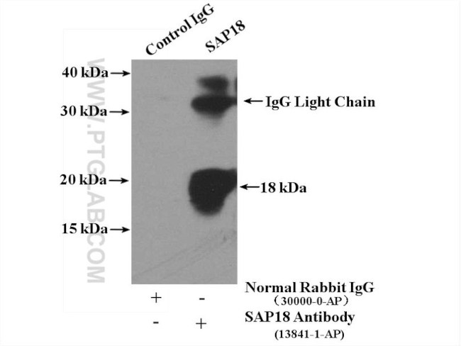 SAP18 Antibody in Immunoprecipitation (IP)