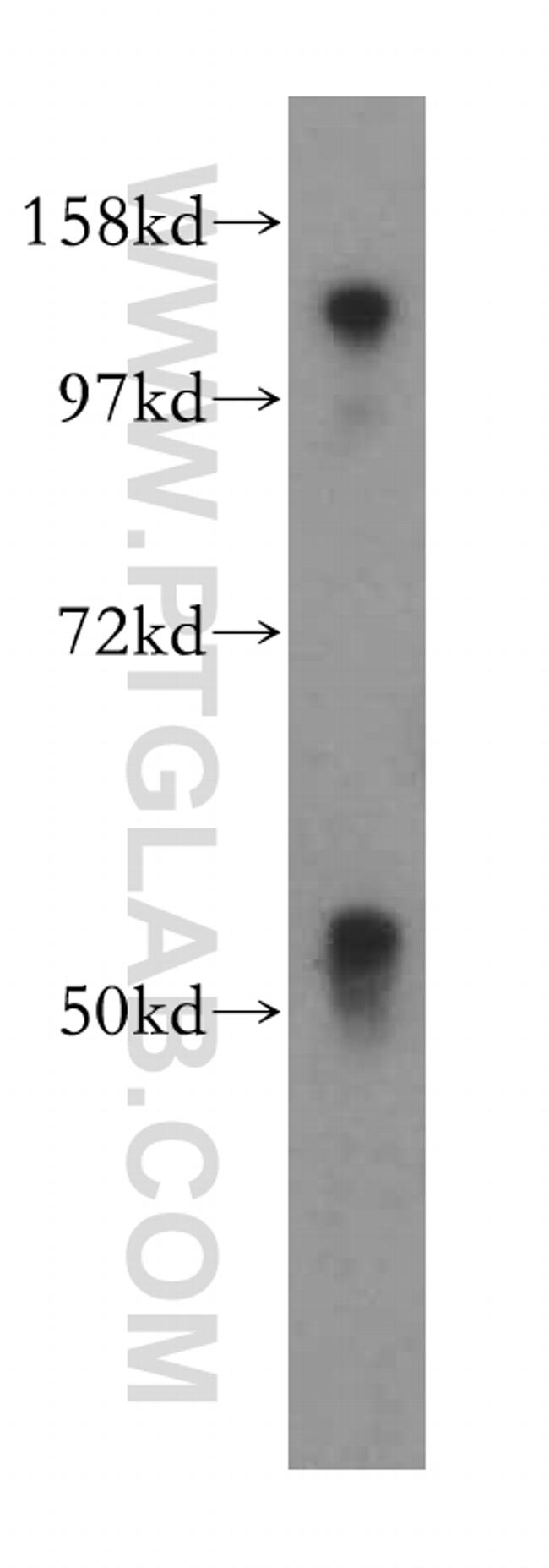 MOF Antibody in Western Blot (WB)