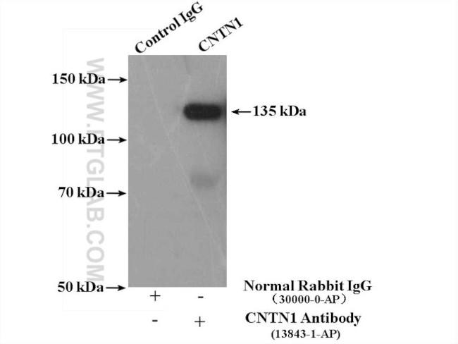 CNTN1 Antibody in Immunoprecipitation (IP)