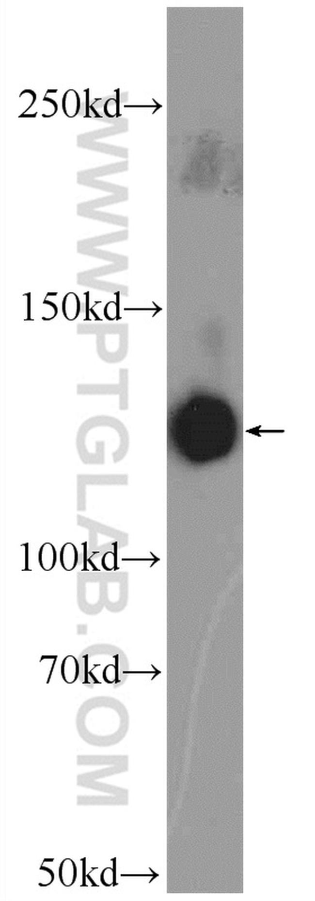 CNTN1 Antibody in Western Blot (WB)