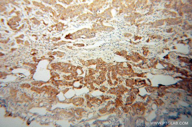 RND2 Antibody in Immunohistochemistry (Paraffin) (IHC (P))