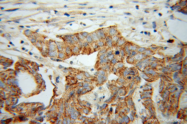 RND2 Antibody in Immunohistochemistry (Paraffin) (IHC (P))