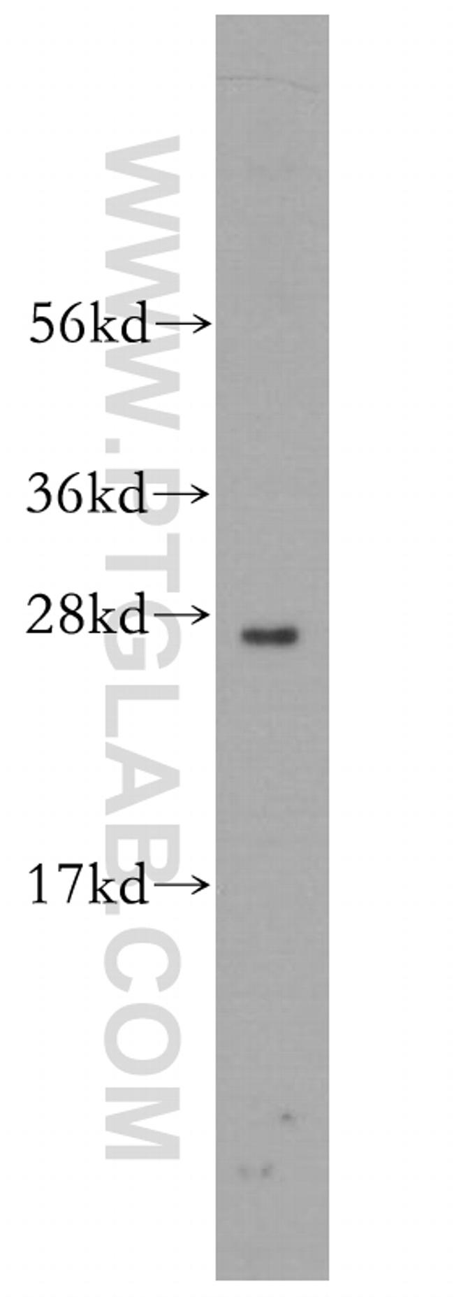 RND2 Antibody in Western Blot (WB)