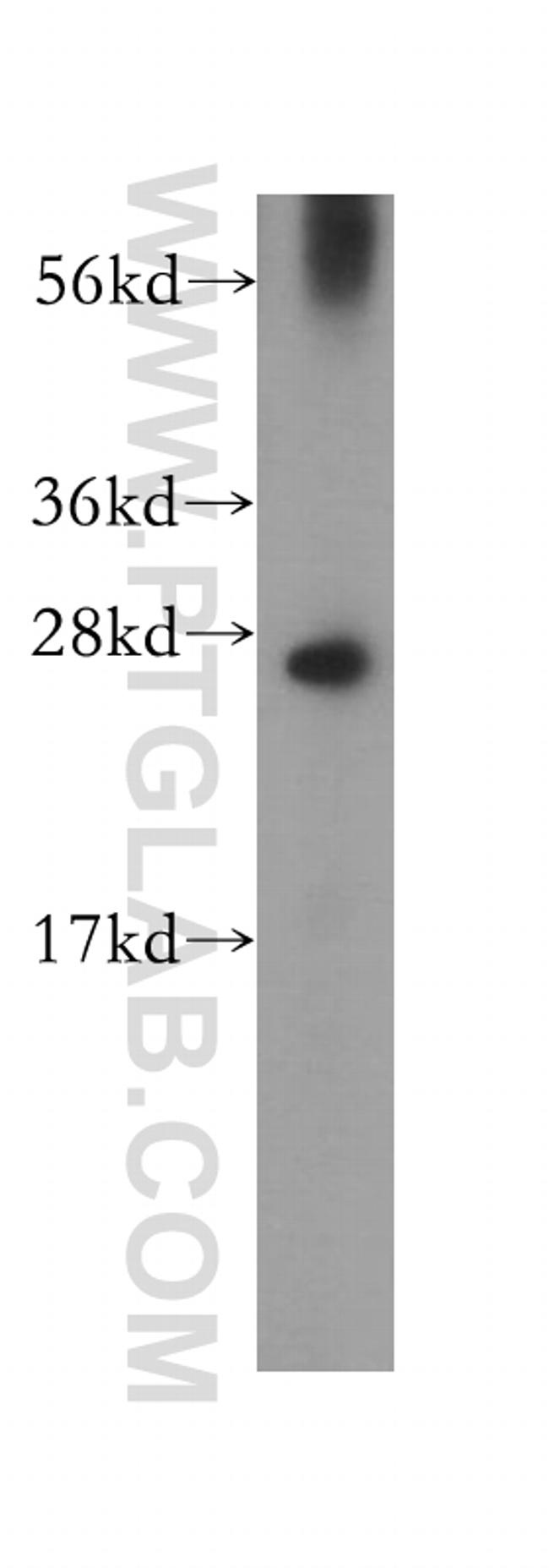 RND2 Antibody in Western Blot (WB)