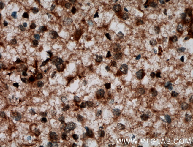 JAKMIP1 Antibody in Immunohistochemistry (Paraffin) (IHC (P))