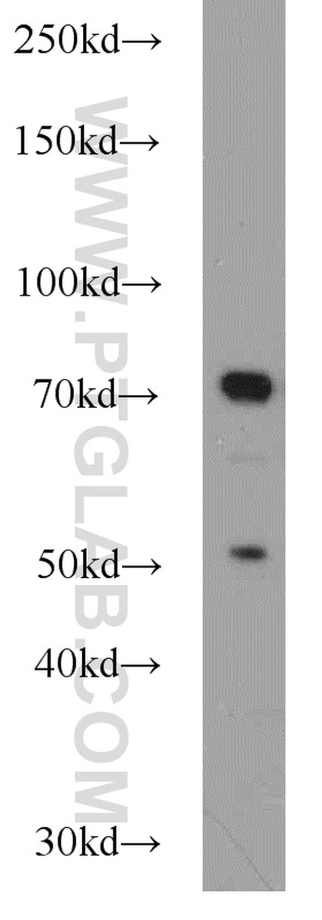 JAKMIP1 Antibody in Western Blot (WB)