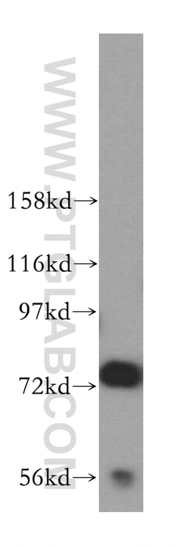 JAKMIP1 Antibody in Western Blot (WB)