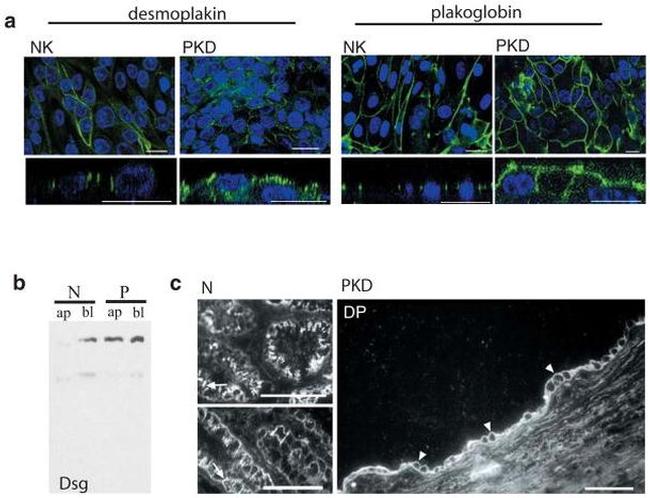 gamma Catenin Antibody in Immunocytochemistry (ICC/IF)