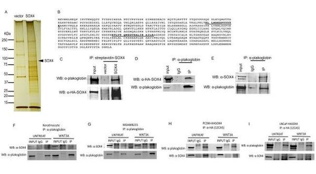 gamma Catenin Antibody in Western Blot, Immunoprecipitation (WB, IP)