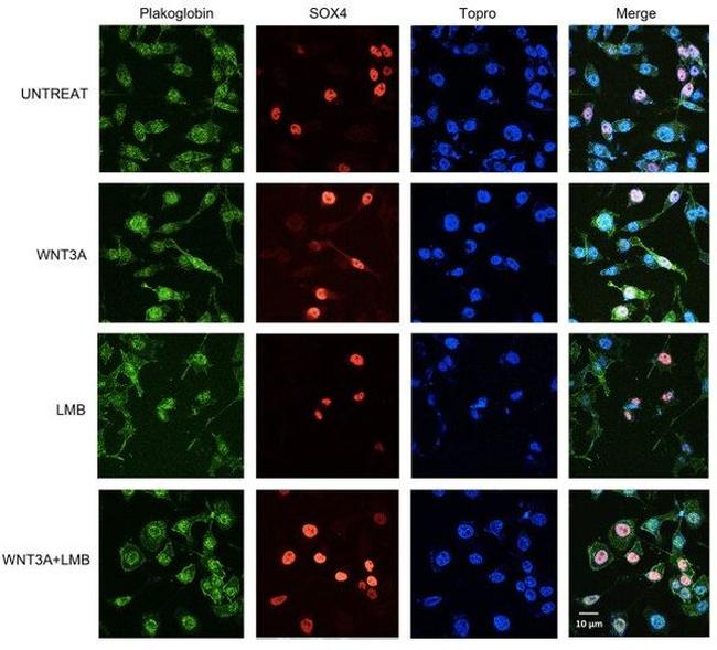 gamma Catenin Antibody in Immunocytochemistry (ICC/IF)