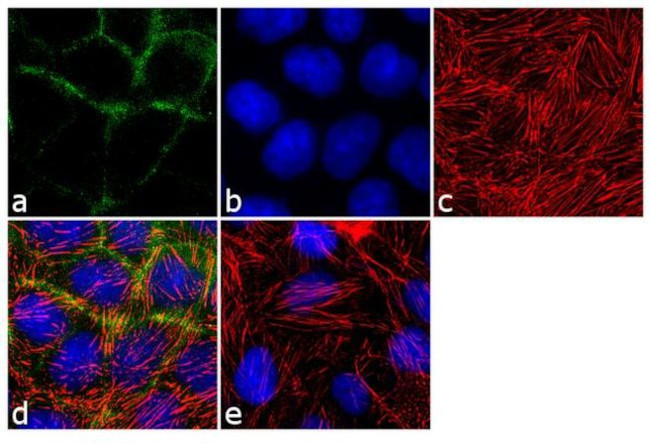 gamma Catenin Antibody in Immunocytochemistry (ICC/IF)