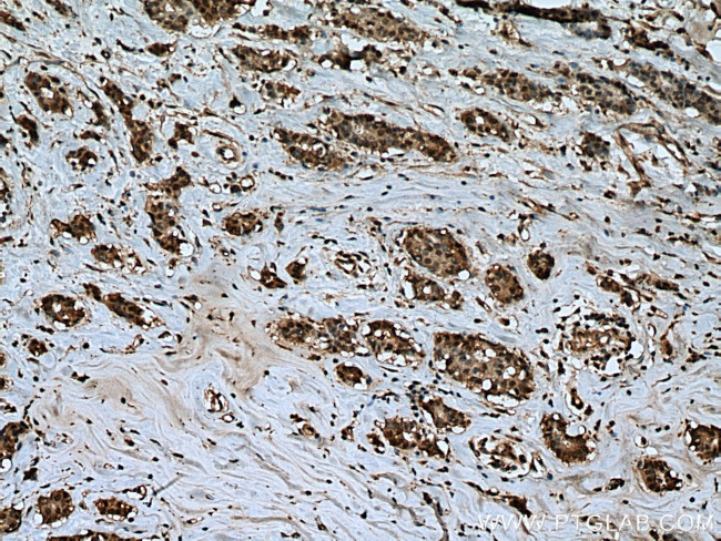 UBP1 Antibody in Immunohistochemistry (Paraffin) (IHC (P))