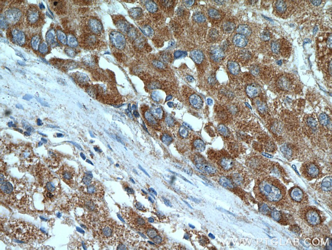 AEG-1/MTDH Antibody in Immunohistochemistry (Paraffin) (IHC (P))