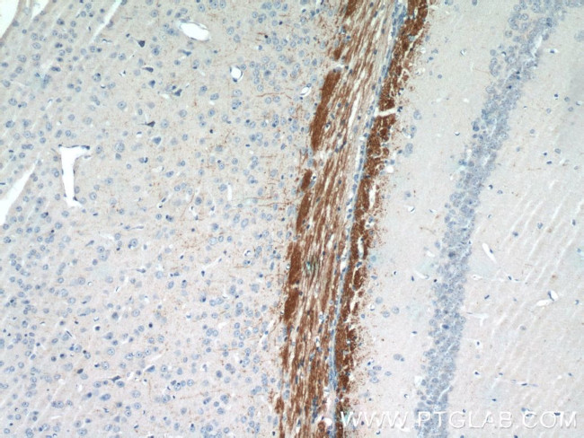 AEG-1/MTDH Antibody in Immunohistochemistry (Paraffin) (IHC (P))