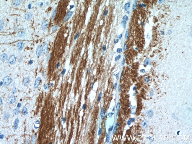 AEG-1/MTDH Antibody in Immunohistochemistry (Paraffin) (IHC (P))