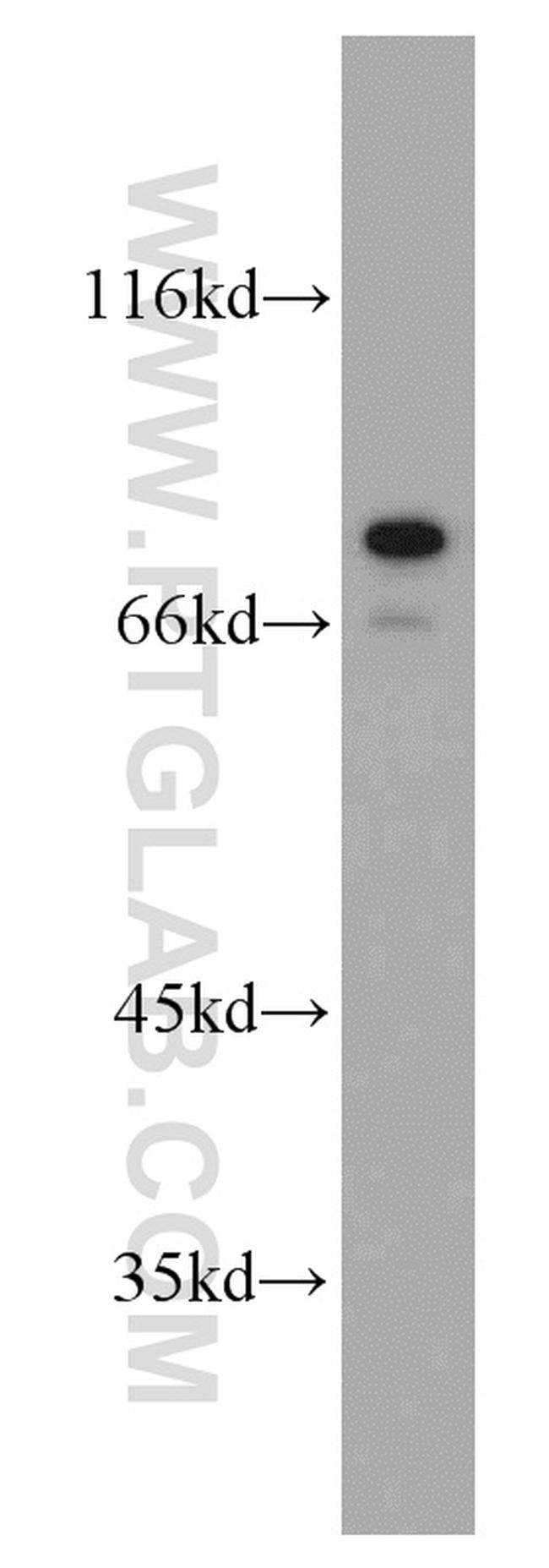 AEG-1/MTDH Antibody in Western Blot (WB)