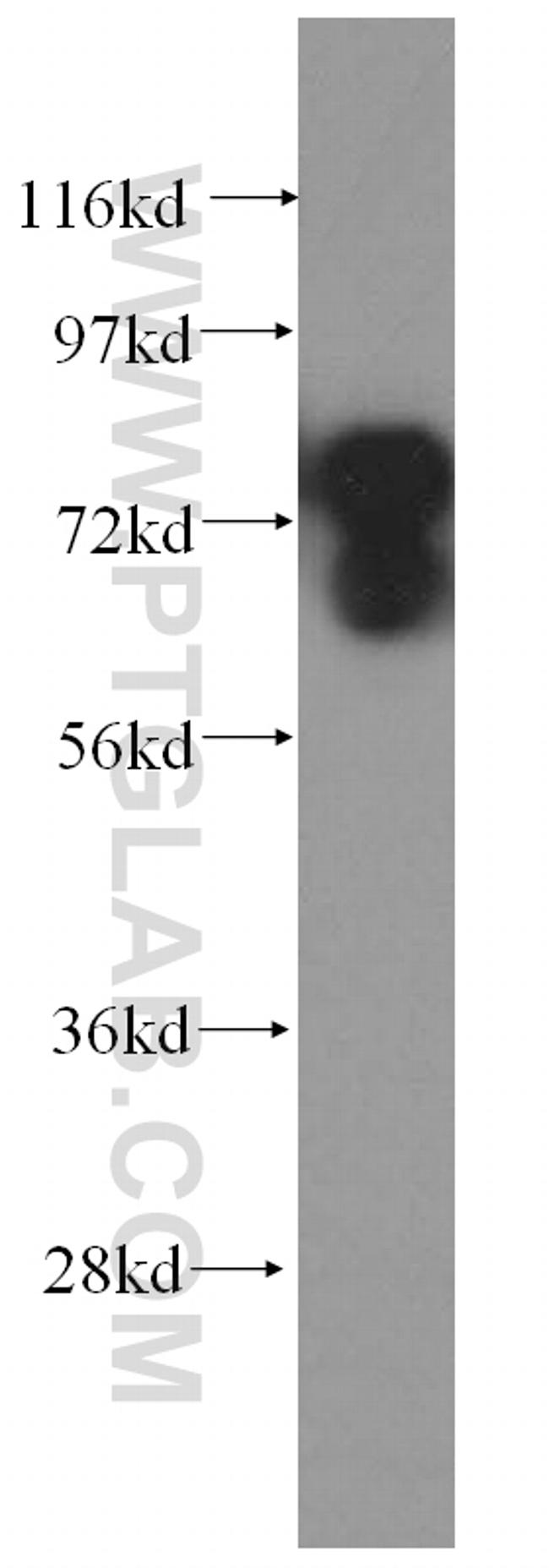 AEG-1/MTDH Antibody in Western Blot (WB)