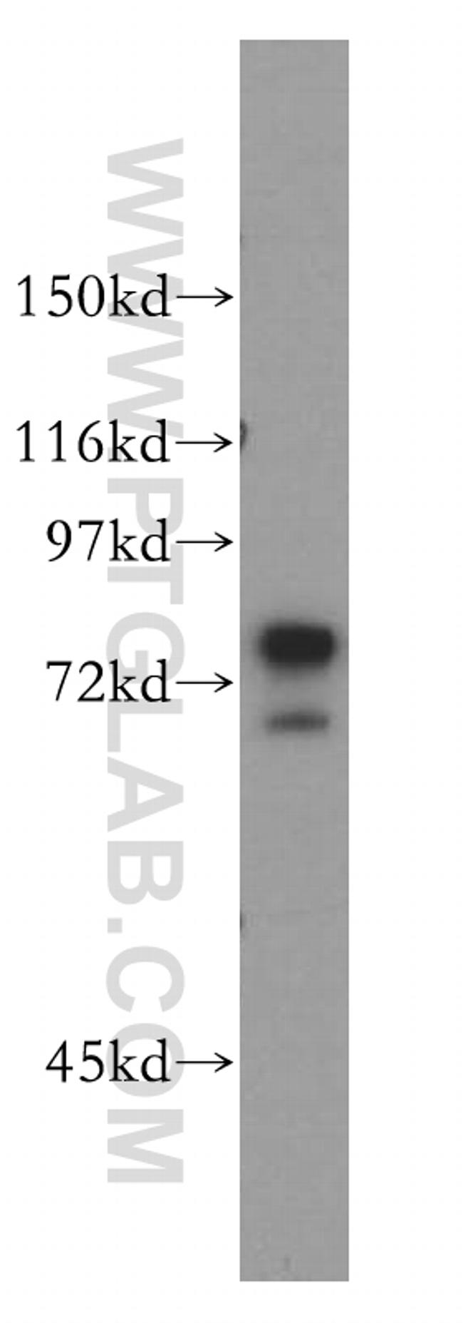 AEG-1/MTDH Antibody in Western Blot (WB)