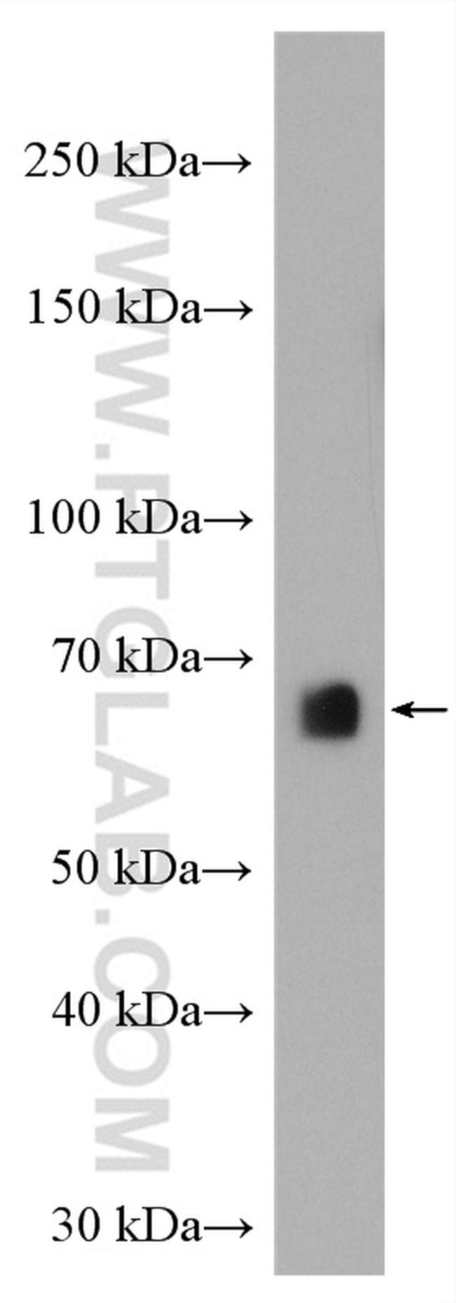 AEG-1/MTDH Antibody in Western Blot (WB)