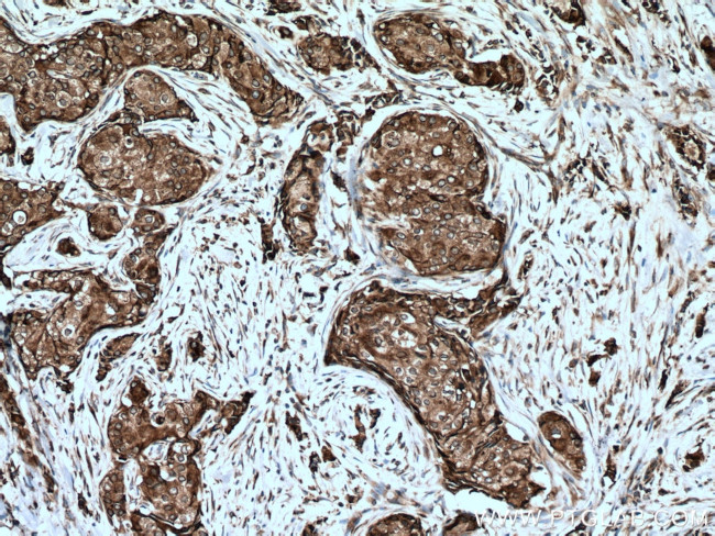 AEG-1/MTDH Antibody in Immunohistochemistry (Paraffin) (IHC (P))