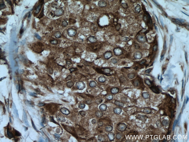 AEG-1/MTDH Antibody in Immunohistochemistry (Paraffin) (IHC (P))