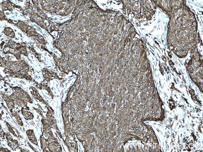 AEG-1/MTDH Antibody in Immunohistochemistry (Paraffin) (IHC (P))