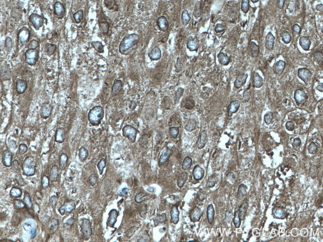 AEG-1/MTDH Antibody in Immunohistochemistry (Paraffin) (IHC (P))