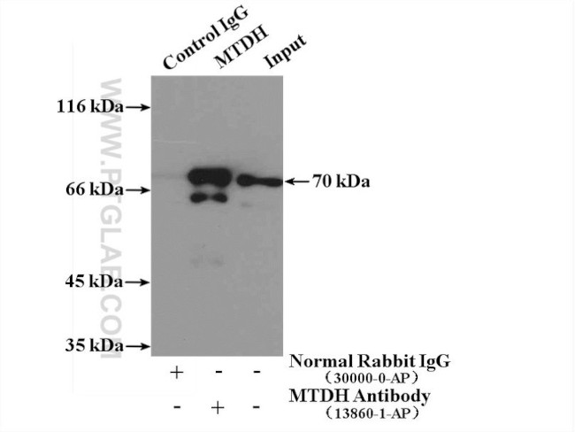 AEG-1/MTDH Antibody in Immunoprecipitation (IP)