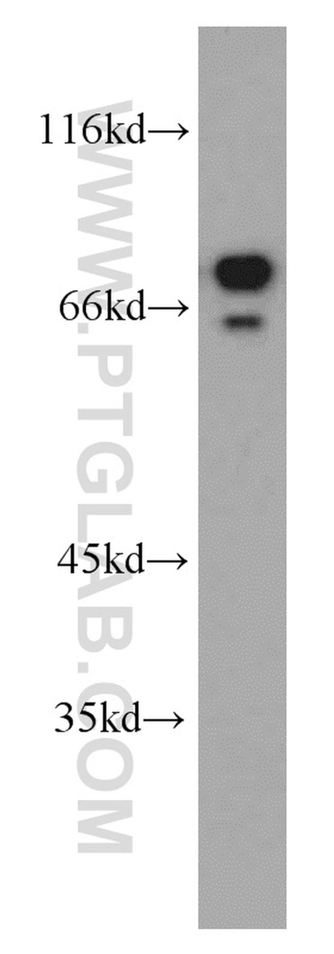 AEG-1/MTDH Antibody in Western Blot (WB)