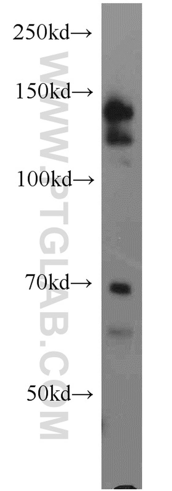 TACC1 Antibody in Western Blot (WB)