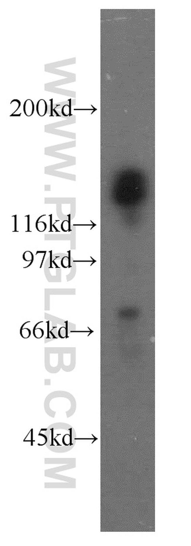 TACC1 Antibody in Western Blot (WB)