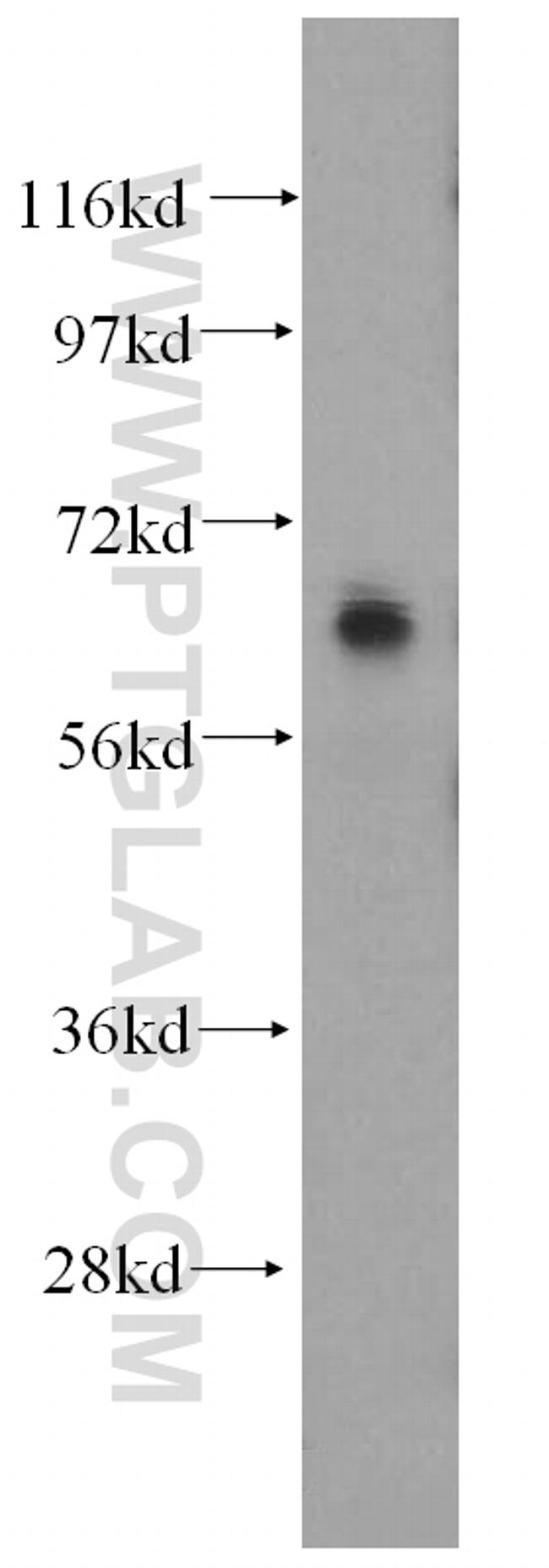 Frizzled 9 Antibody in Western Blot (WB)