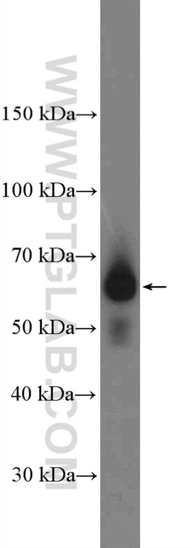 Frizzled 9 Antibody in Western Blot (WB)