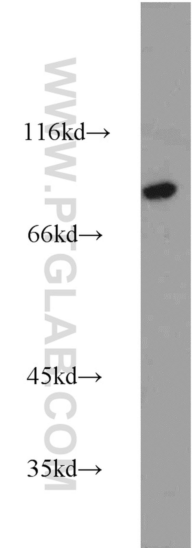 Calpain 7 Antibody in Western Blot (WB)