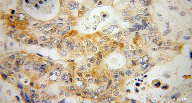 KBTBD2 Antibody in Immunohistochemistry (Paraffin) (IHC (P))