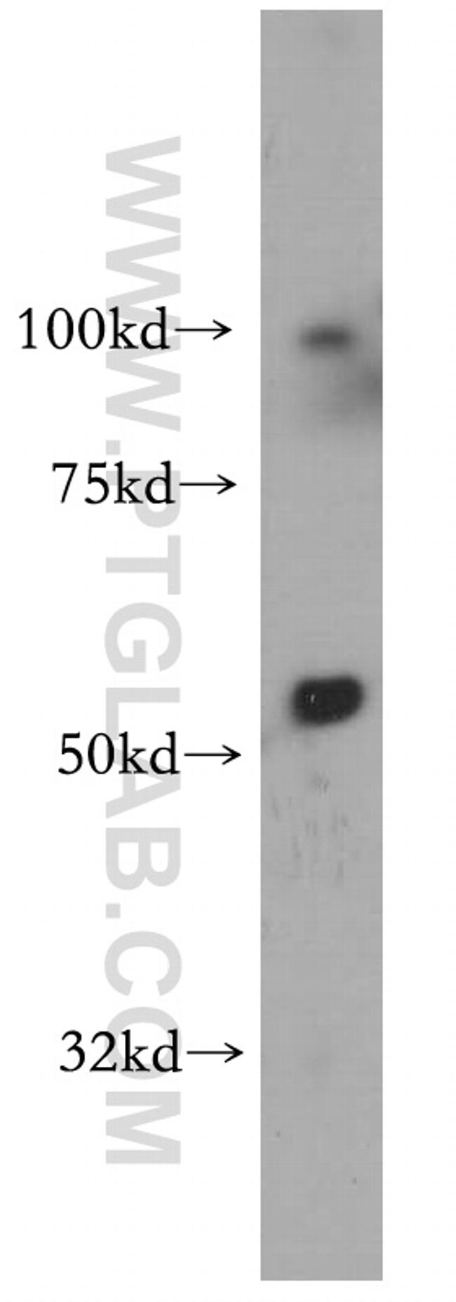 S1PR5/EDG8 Antibody in Western Blot (WB)