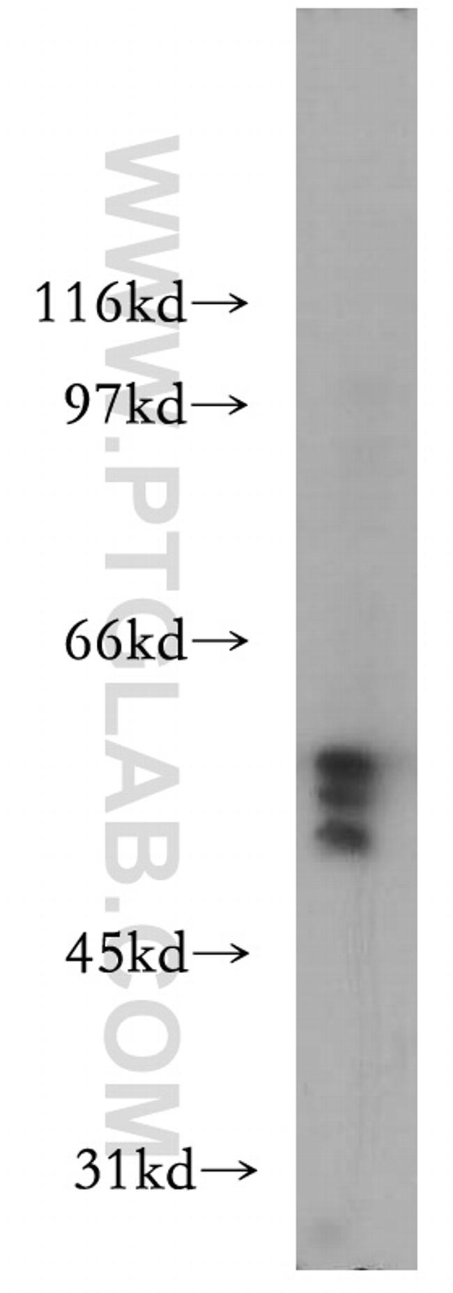 S1PR5/EDG8 Antibody in Western Blot (WB)