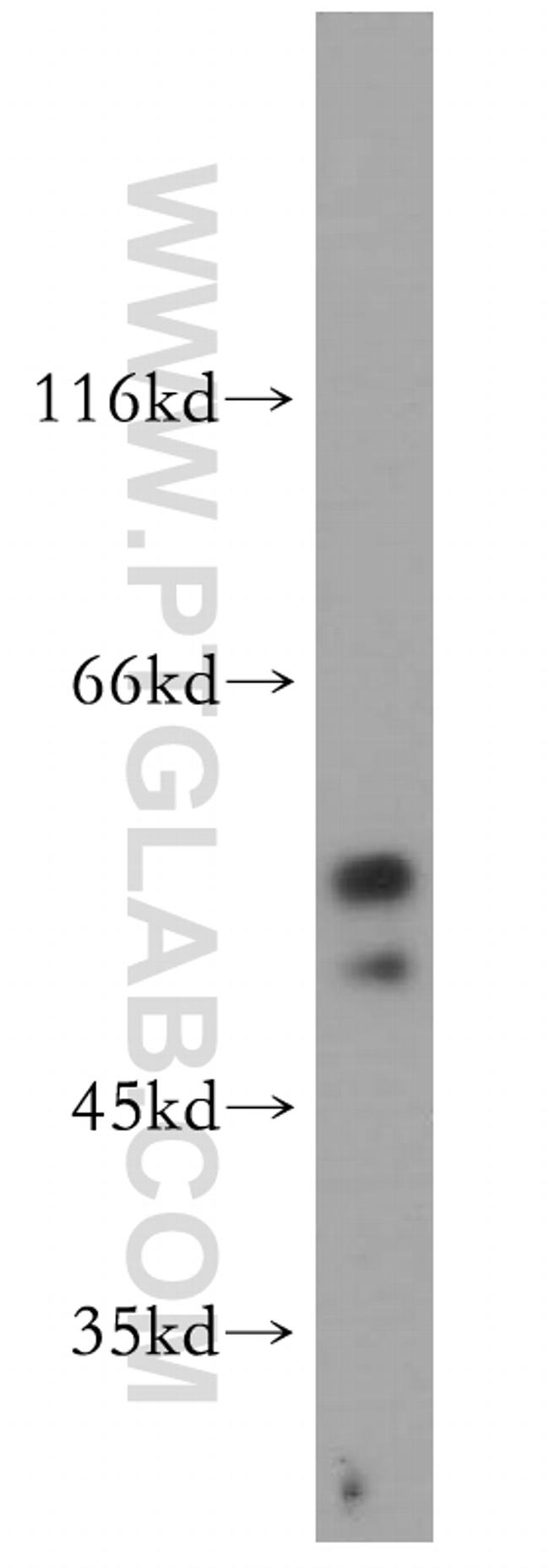 S1PR5/EDG8 Antibody in Western Blot (WB)