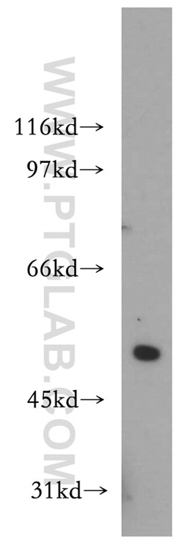 S1PR5/EDG8 Antibody in Western Blot (WB)