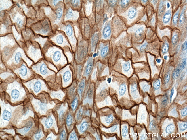 Desmocollin 2 Antibody in Immunohistochemistry (Paraffin) (IHC (P))