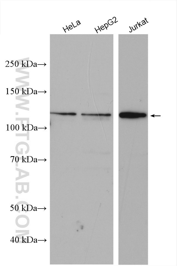 Desmocollin 2 Antibody in Western Blot (WB)