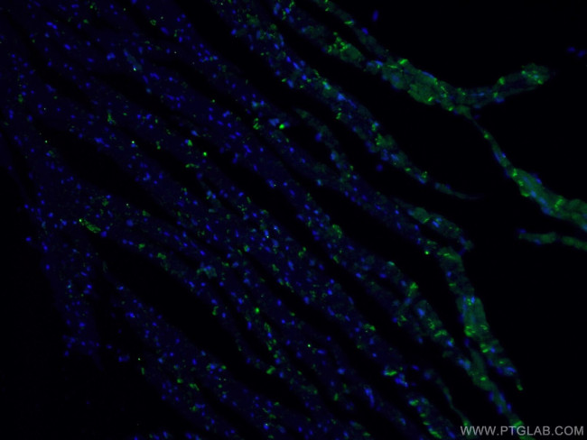 Desmocollin 2 Antibody in Immunohistochemistry (PFA fixed) (IHC (PFA))